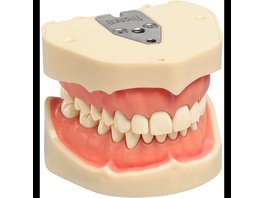 Arbeitsmodell ANA-4 / ANKA-4 - Stück OK/UK inklusive 28 Klick-Zähne