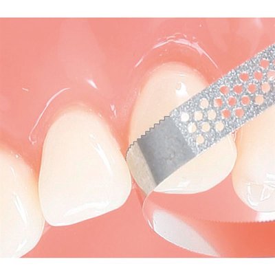 Diam. pásky s pilkou perfor. 2,5mm 45my 10 ks - modré standard