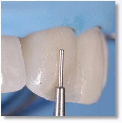 LM-Arte Misura, LM 496-497 XSI