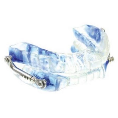 TELESCOPIC ADVANCER Large- aparátek proti chrápání