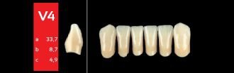 Ref-Line Anterior A4 V4