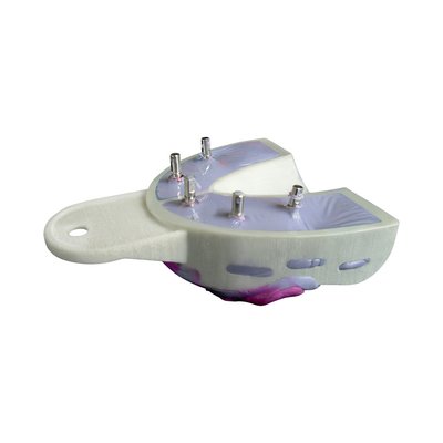 Miratray Implant dolní I1 6ks malá