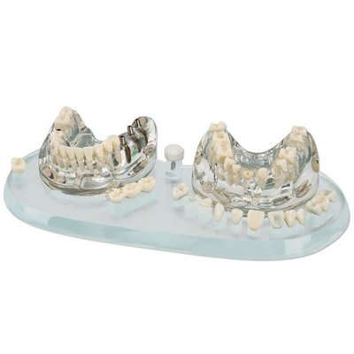 Studijní model Protetický/Implantologický