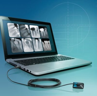 Radiografia Videograph HD