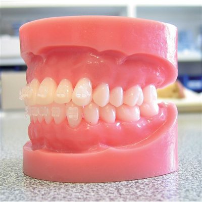 Purity brekety Roth s háčky .022 10 ks horní