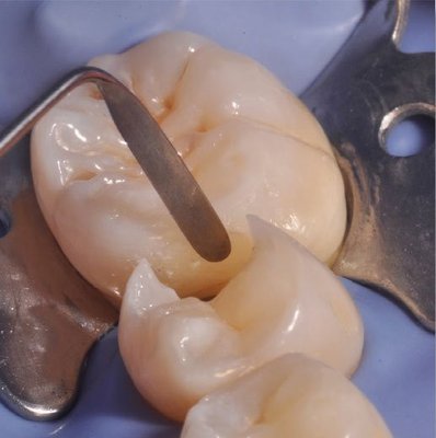 LM-Arte Applica Twist, LM 464-494 ES