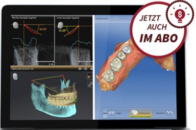 SICAT Function Starterkit