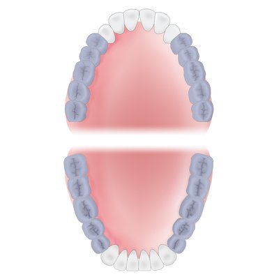 Gracey 10 XP-AEG10XPQT
