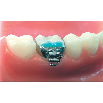 Secure LC intro kit