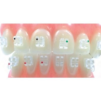 Transparentní zámky GHIACCIO Roth horní/dolní 3-3 slot .018 1 sada (12 ks)