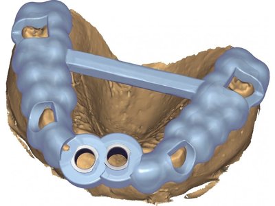 exoplan Guide creator