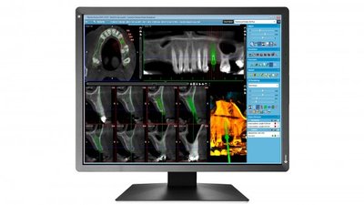 EIZO MX217-HB RadiForce (RK 6)