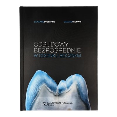 Odbudowy bezpośrednie w odcinku bocznym