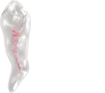 Cvičný zub premolar 1 kanálek