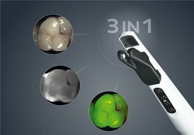 DIAGNOcam Vision Full HD