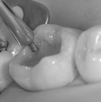 LM-Arte Posterior Misura, LM 498-499 ES