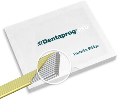 Dentapreg PFU Posterior Bridge