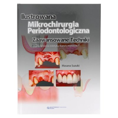 M. Suzuki - Ilustrowana Mikrochirurgia Periodontologiczna