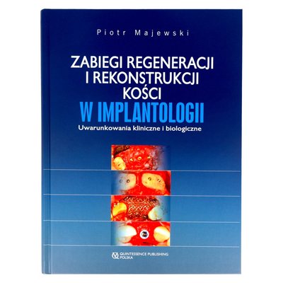 P. Majewski - Zabiegi regeneracji i rekonstrukcji kości w implantologiii