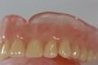 Perflex AcryFree - akryl do wtrysków 200g