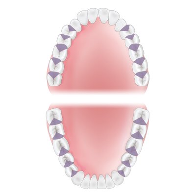 Gracey 16 XP-AEG16XPQT