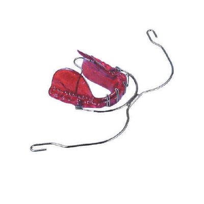 MIM aktivační kanyla pro extraorální oblouk průměr .045" 10 ks