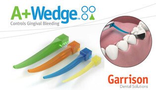 Kliny A+Wedge S niebieskie 100szt. Garrison (kliny hemostatyczne nasączone płynem Astringent)