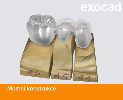 Exocad mostní konstrukce