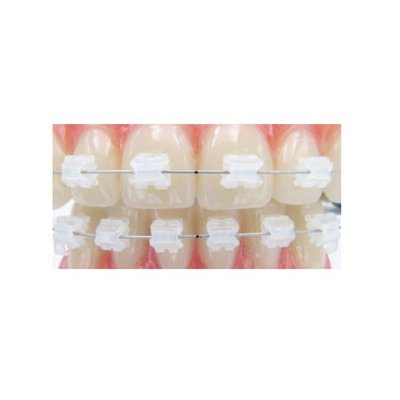 Estetické zámky AQUA Roth horní 3-3 .018 6 ks