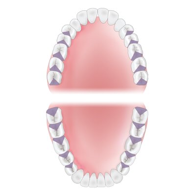 Gracey 17 XP-AEQ17XPQT