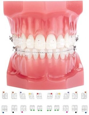 Zamki krystaliczne ClearViz+ MBT 018 (5-5) góra/gół z hacykami na 3,4,5 DynaFlex CLEARVIZ+ BRACKETS 5X5 SET MBT 018 HOOKS ON3"S, 4"S & 5"S