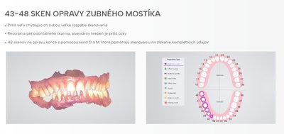 Náhled 7