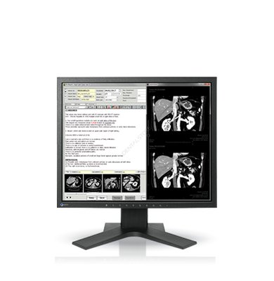 Monitor EIZO 19 RadiForce MX194 - z kalibracją i testami