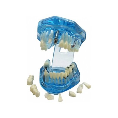 Model čelisti, modrý transparentní