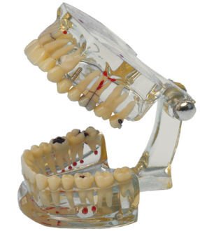 Model chrupu Transparent Plus