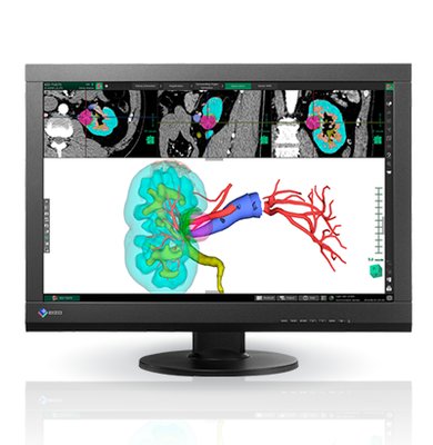 Monitor EIZO 24 RadiForce MX243W-BK 16:9 - z kalibracją i testami