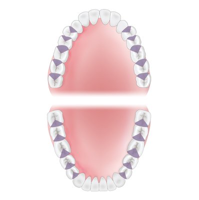 Gracey 12 XP-AEG12XPQT