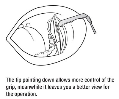Medesy 925 a 926 - Obwegeser retraktory