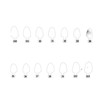 33-Polykarbonátové korunky 5ks