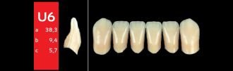 Ref-Line Anterior BL1 U6