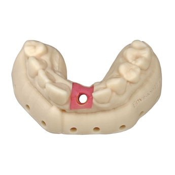 E-Gum (for D4K Pro Dental)