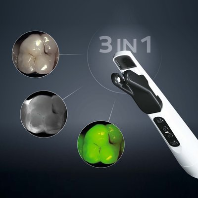 DIAGNOcam Vision Full HD - 1 ks