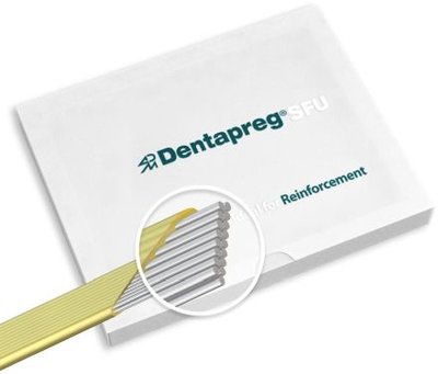 Dentapreg SFU Reinforcement