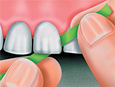 Brusné pásky 30 micron - 10 m