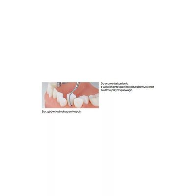 P1 - Końcówka do periodontologii
