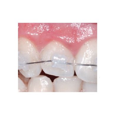 Ligatury SLIDE Aqua malé 60ks