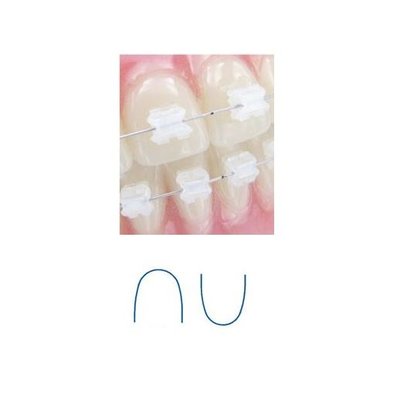 MEMORIA mimetické obloukové dráty s vrstvou rhodia, kulaté horní .012, 10ks