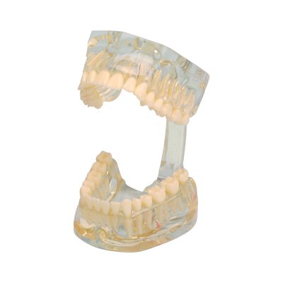 Model chrupu Transparent