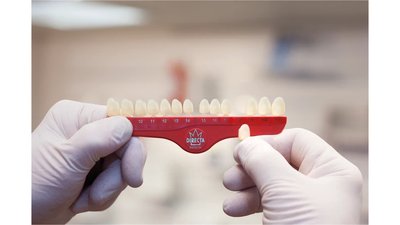 DIRECTA Provisorische Polycarbonat-Kronen