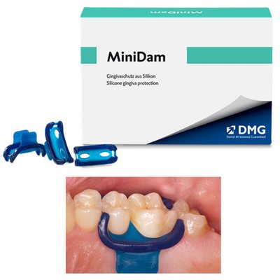 MiniDam (kofferdam) DMG